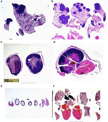 Enhanced Mortality to Metastatic Bladder Cancer Cell Line MB49 in Vasoactive Intestinal Peptide <mark class="highlighted">Gene Knockout Mice</mark>
